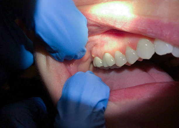 Best Weekend Emergency Dentist in Judsonia, AR